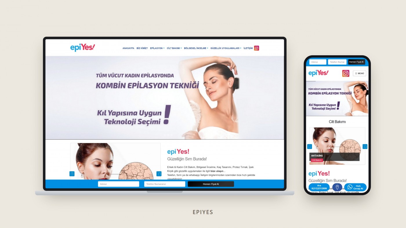EpiYes