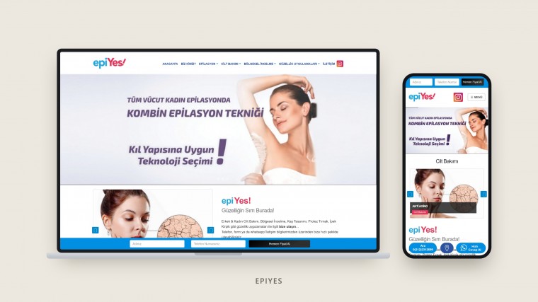 EpiYes